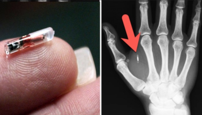 Legislation could potentially limit how employers use implantable microchips