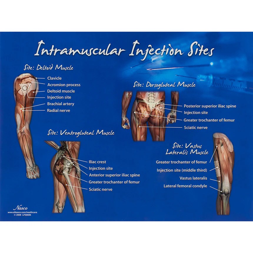 A nurse is preparing to give an intramuscular injection