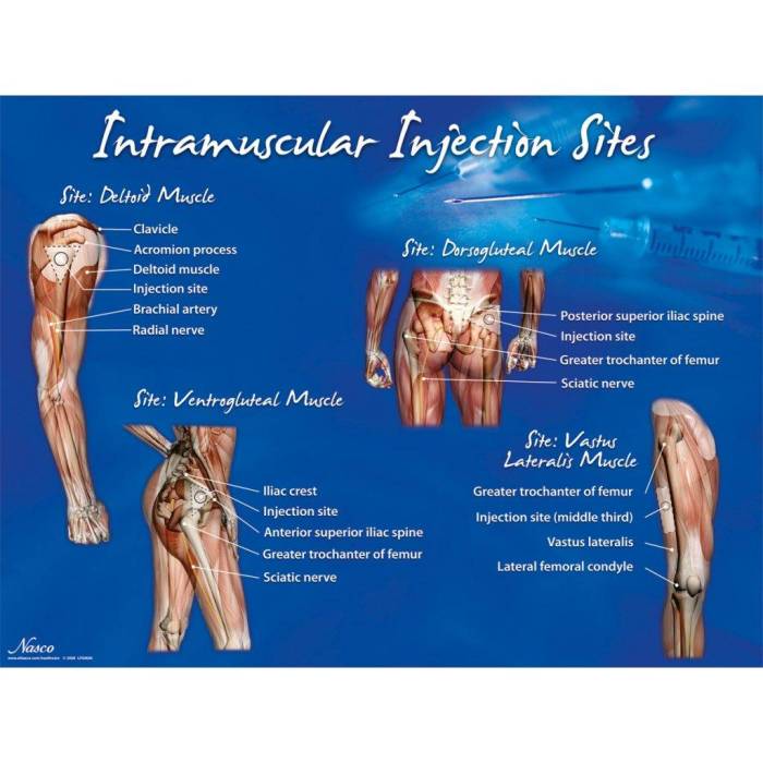 Phil cdc injection intramuscular