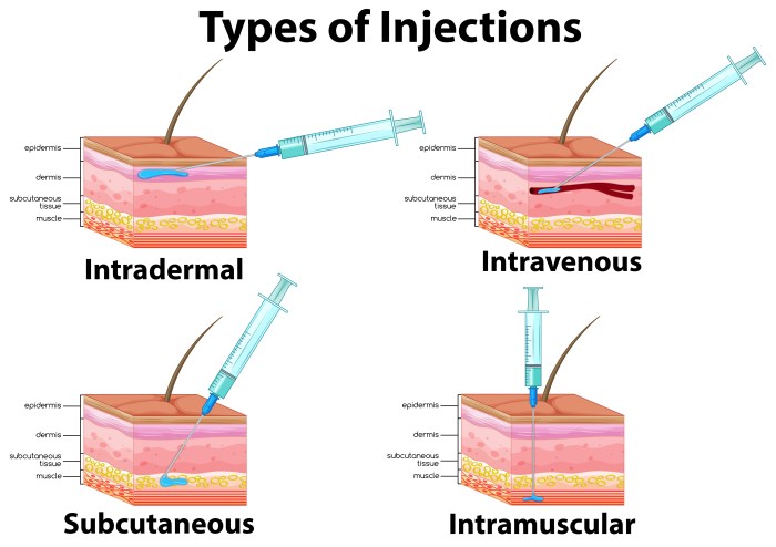 Intramuscular